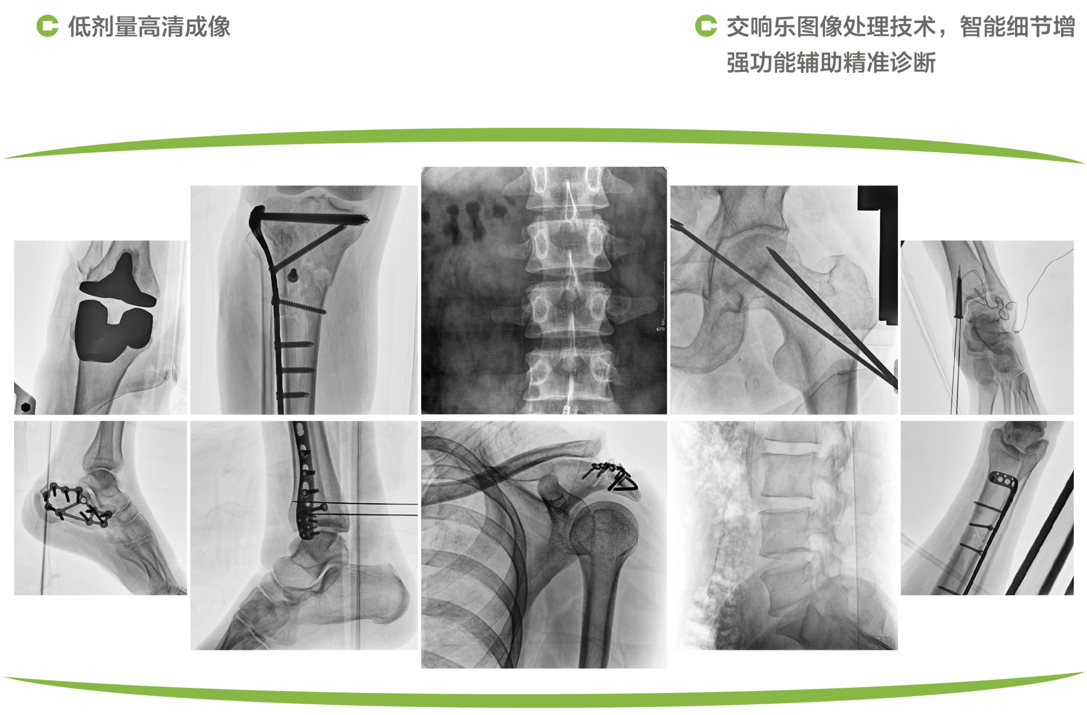 6移動式C形臂X射線機5.png